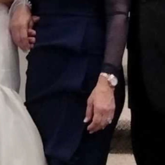 Chiari  boni la petite robe - Picture 4 of 5